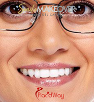 Slider image (3) Smile Makeover Playa Del Carmen